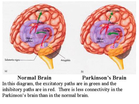 From Parkinsons To Huntingtons