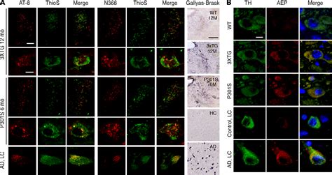 Figure From Norepinephrine Metabolite Dopegal Activates Aep And