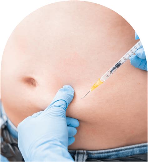 Fat Dissolving Injections Skin And Vain