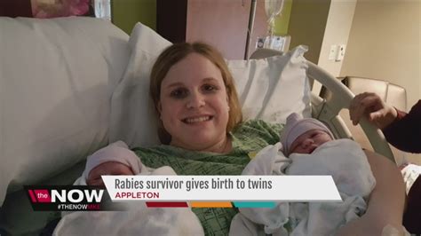 Wisconsin rabies survivor Jeanna Giese-Frassetto gives birth to twins ...