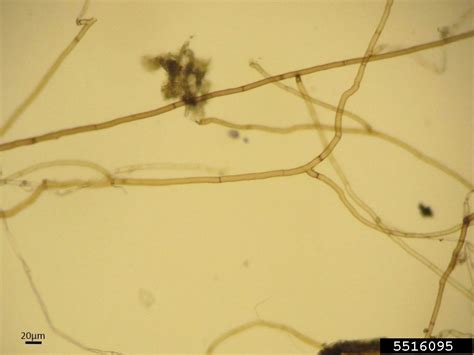 Rhizoctonia damping-off, blight and rot (Rhizoctonia solani)