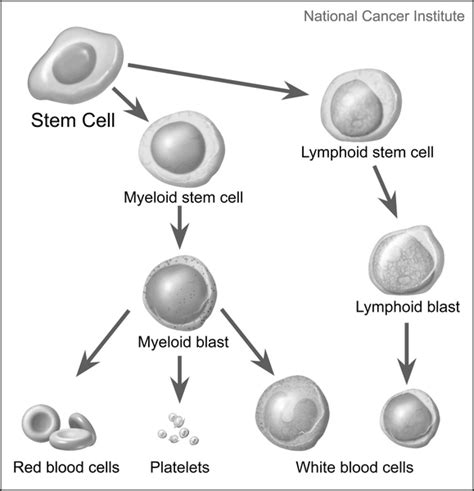 Familial Acute Myeloid Leukemia With Mutated Cebpa Medlineplus Genetics