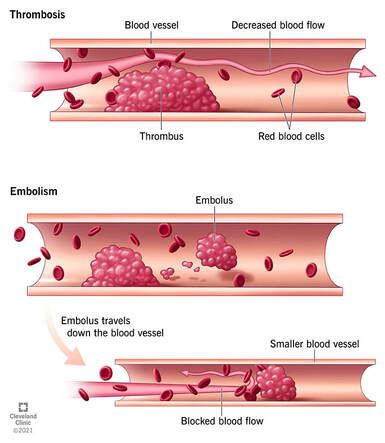 BLOOD VESSEL DISEASE Cell Tissue Technology