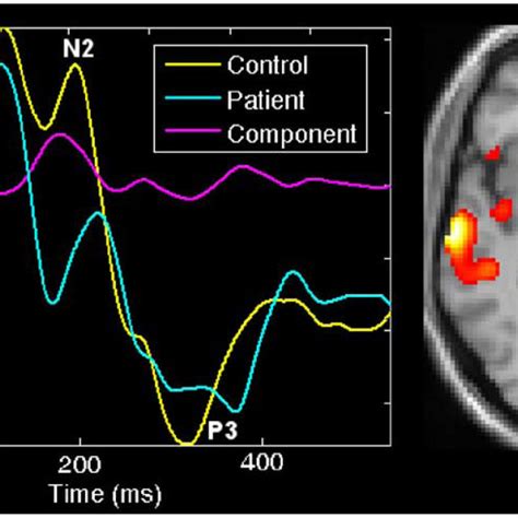 ERP FMRI JICA Joint Component That Showed Significantly Different