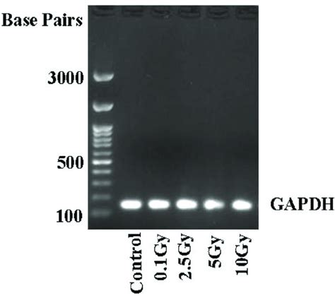 Gene Expression Pattern Of Gapdh Primers In Post Irradiated Ht 29 Cell Download Scientific