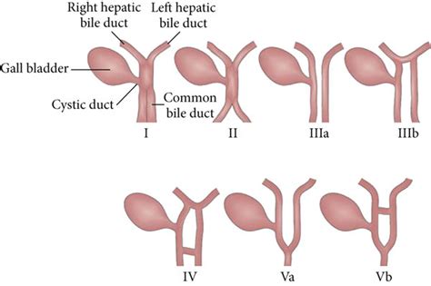 Types Of Bile Duct Duplication Download Scientific Diagram