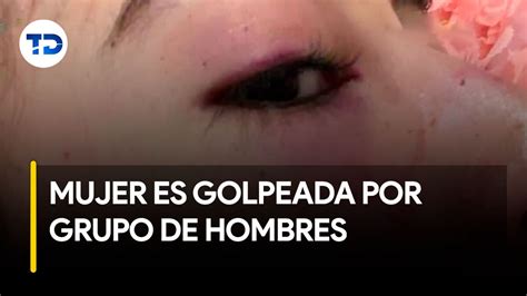 Mujer narra golpiza por parte de varios hombres sin razón alguna