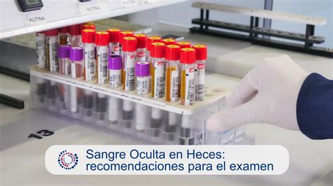 Alerta Sanitaria Conoce Los Alimentos Prohibidos Si Tienes Sangre