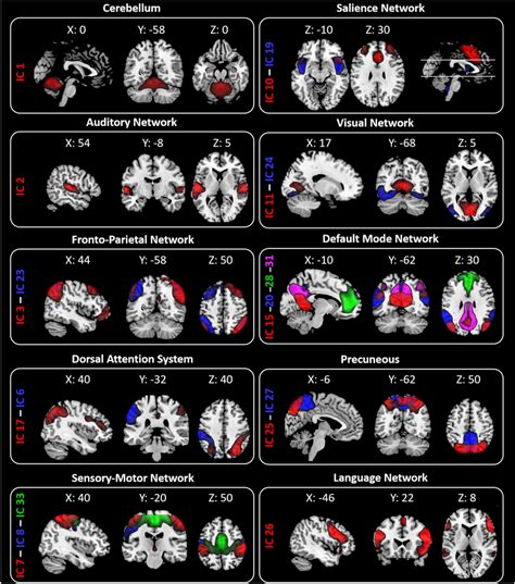 Resting State Networks Rsns Identified By Gift Twenty Spatial Maps