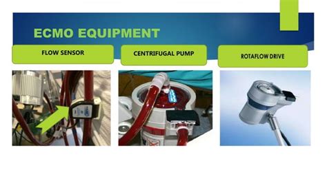 Ecmo Extracorporeal Membrane Oxygenation Ppt