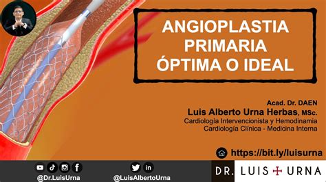 Angioplastia Coronaria Primaria Ptima O Ideal Youtube