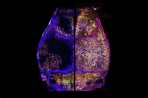 Skull Bone Marrow Expands Throughout Life And Remains Healthy During