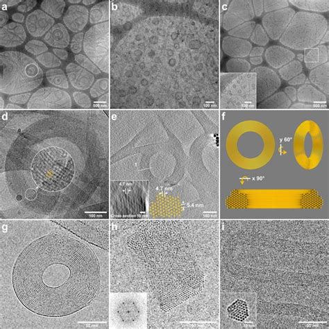 Cryo Tem Overview Showing The Toroidal Structures Of A Mpeg