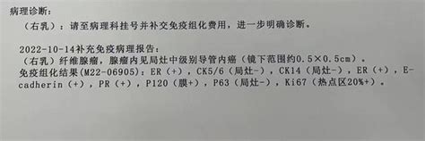 乳腺癌病理报告到底该如何看？教你读懂乳腺癌病理报告单 知乎