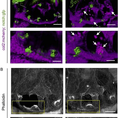 Abnormal cartilage behaviour and macula hair distribution in ears of ...