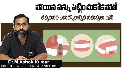 పయన పనన పటటచకకపత Risks of Not Replacing Missing Teeth