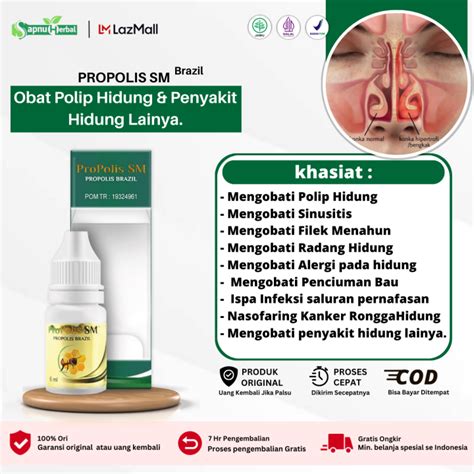 mengobati benjolan   hidung polip hidung perontok