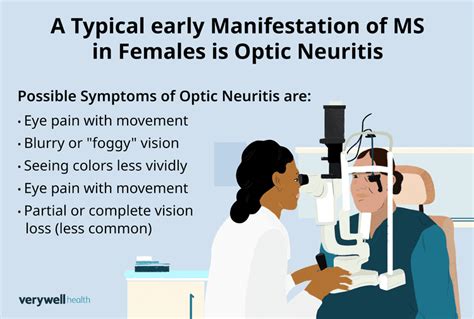 Symptoms of MS in Women: Early Clues to Look For