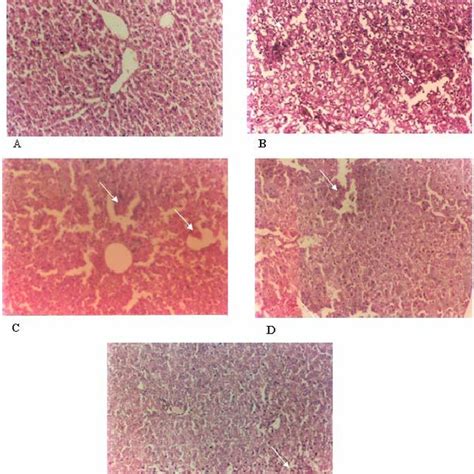 Assessment Of Ccl 4 Induced Hepatotoxicity By Histopathology In