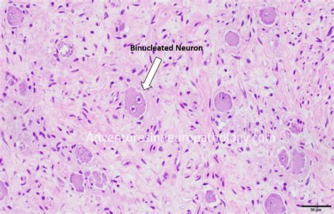 Posterior Dorsal Root Ganglion