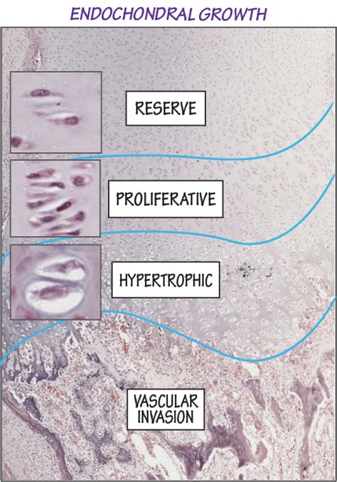 Bone Growth Endochondral Linear Histology Flashcards Ditki Medical And Biological Sciences