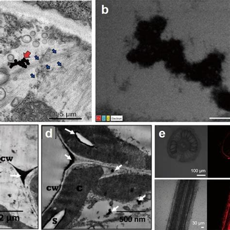 Transport And Distribution Of Nps In Plants A Tem Image Of Ag Nps In