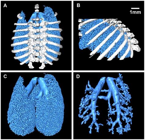 3d Lung Images A Front View Of The Lung B Right Side View Of The