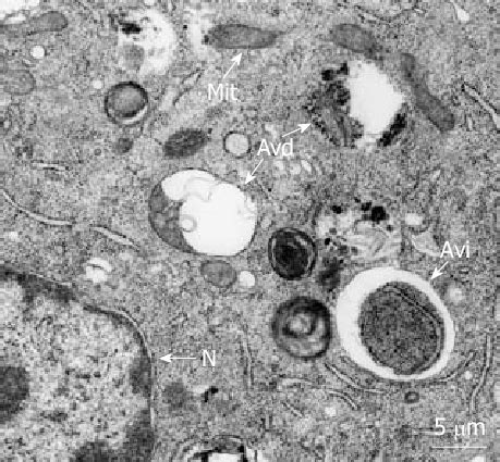 Morphology Of Autophagic Vacuoles Typical Autophagic Vacuoles From 3T3