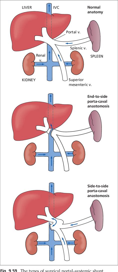 Figure 9 30 From The Hepatic Artery Portal Venous System And Portal