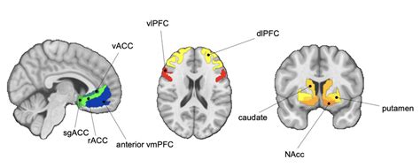 Fronto Striatal Regions Of Interest ROIs Abbreviations NAcc