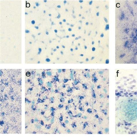 Transgene Expressing Cells Are Excluded From Cartilage Nodules A And