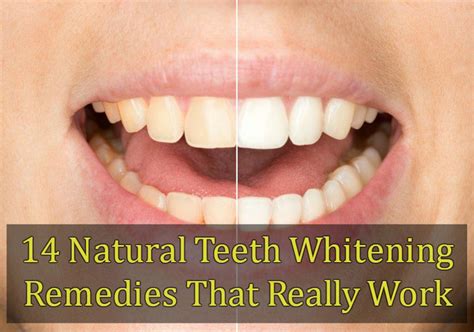 14 Natural Teeth Whitening Remedies That Really Work