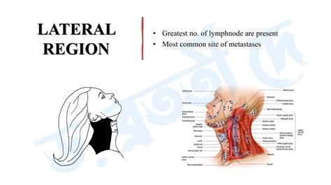 Differential Diagnosis Of Lymphadenopathy Ppt