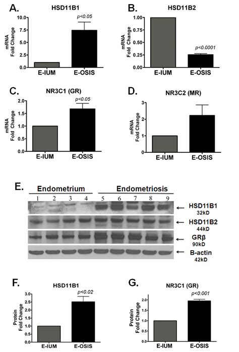 Figure 2 From Activated Glucocorticoid And Eicosanoid Pathways In