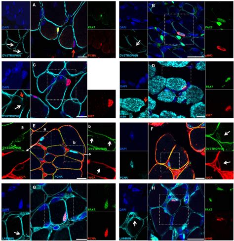 Activated Pax Cells Are Situated Over Regions Without Dystrophin Or