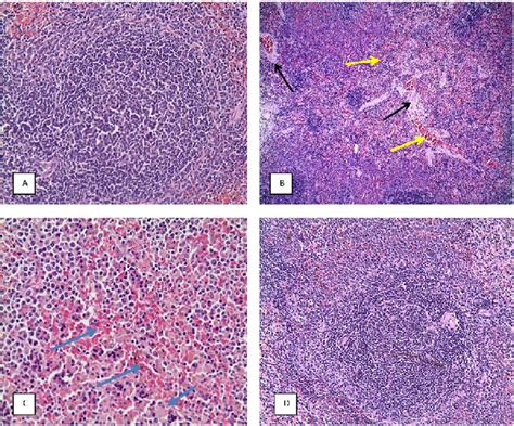 Hande X20 A Spleen Of Cg B Spleen Of Tg Showing Splenic Hemorrhage Download Scientific