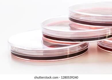 Group Eosin Methylene Blue Emb Agar Stock Photo 1280539240 Shutterstock