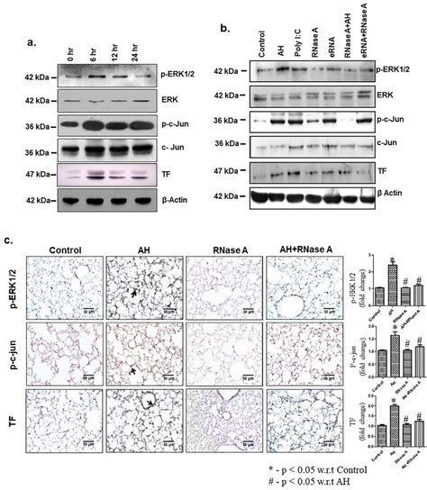 AH Induced ERNA Expression Facilitates ERK1 2 And C Jun Phosphorylation