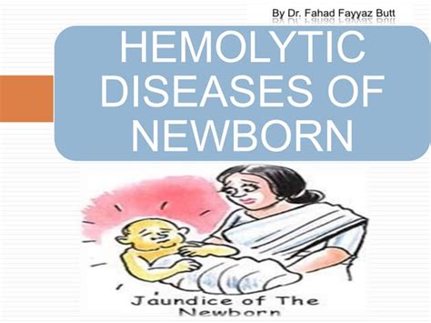 Hemolytic Disease Of Newborn Ppt