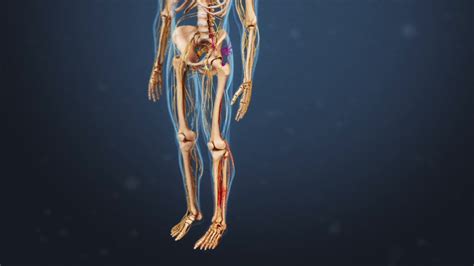 Types of Sciatic Nerve Pain | Spine-health