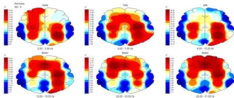 Eletroencefalograma e Mapeamento Cerebral New Clinic Clínica médica