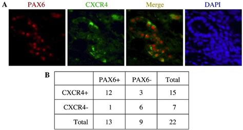 Pax And Cxcr Are Expressed In Primary Human Pancreatic Cancer Tissue