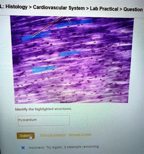 Solved Identify Highlighted Cardiac Cell L Histology Cardiovascular