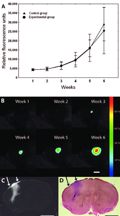 Intracranial Tumour Growth Assessed By In Vivo Epi Illumination