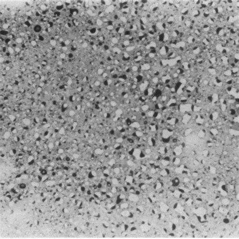 Photomicrograph Of Liver Section From A B6c3f1 Mouse Given 60 Mgkg Download Scientific Diagram