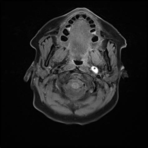 Image Radiopaedia Org