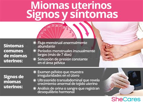 Sintomas De Los Miomas Uterinos NBKomputer