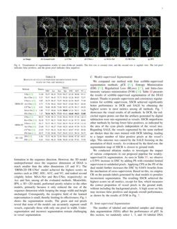 Dias A Comprehensive Benchmark For Dsa Sequence Intracranial Artery