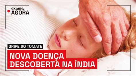 Gripe do tomate o que se sabe sobre doença identificada na Índia YouTube