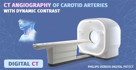 Carotid Artery Ct Angiography With Dynamic Contrast National Surgery Center